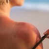 Abbronzatura sicura: tutti i consigli per prendere il sole senza rischi